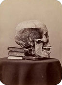 Auteur non identifié : "Crâne d’une tombe gauloise de Caranda"