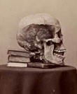 Anonyme, Crâne d'une tombe gauloise de Caranda